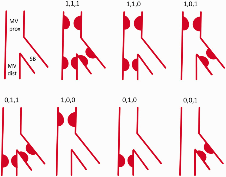 Medina Classification of Bifurcation Lesions