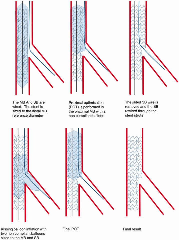 Evolution of crush techniques