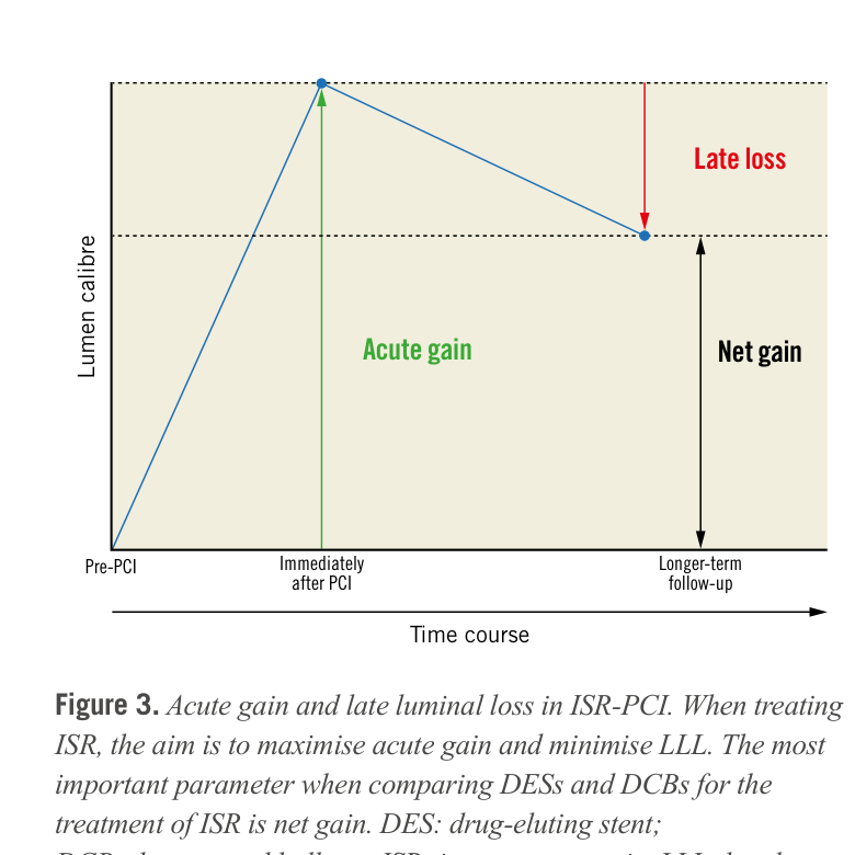 Acute gain and late lumen loss concept diagram